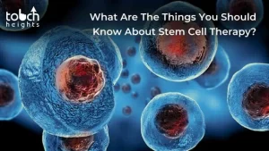 What Are The Things You Should Know About Stem Cell Therapy?