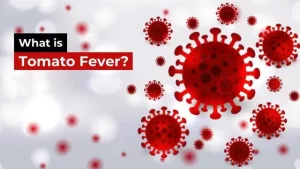 What is Tomato Fever? What are its symptoms and preventions?