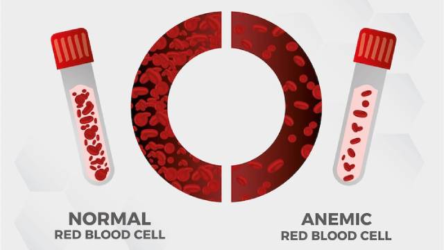 What is Anemia