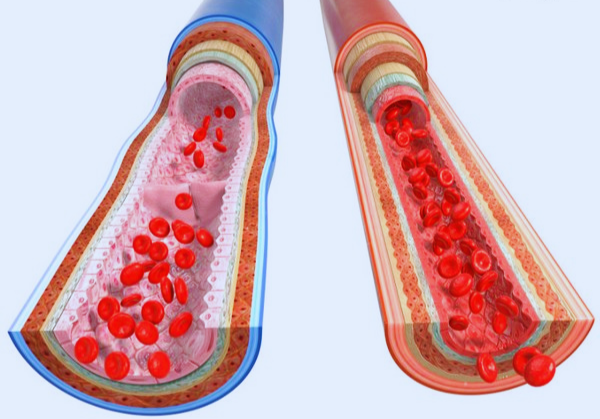 woman's blood type